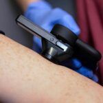 La start-up Anglaise Skin Analytics lève 4M£ pour utiliser l'intelligence artificielle contre le cancer de la peau